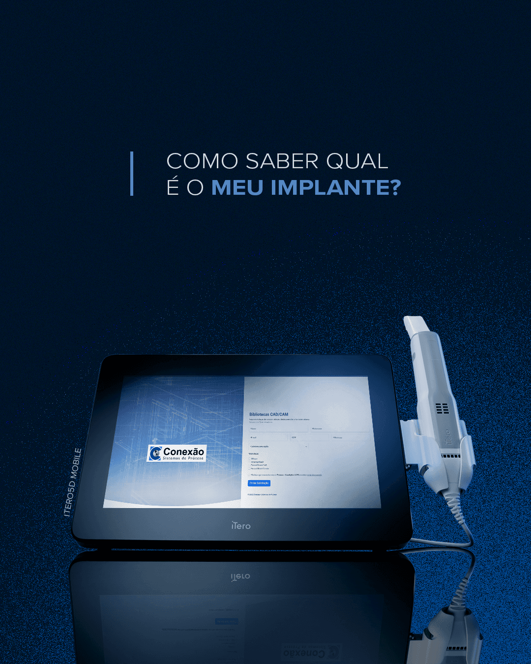 Como Saber Qual é o Meu Implante?