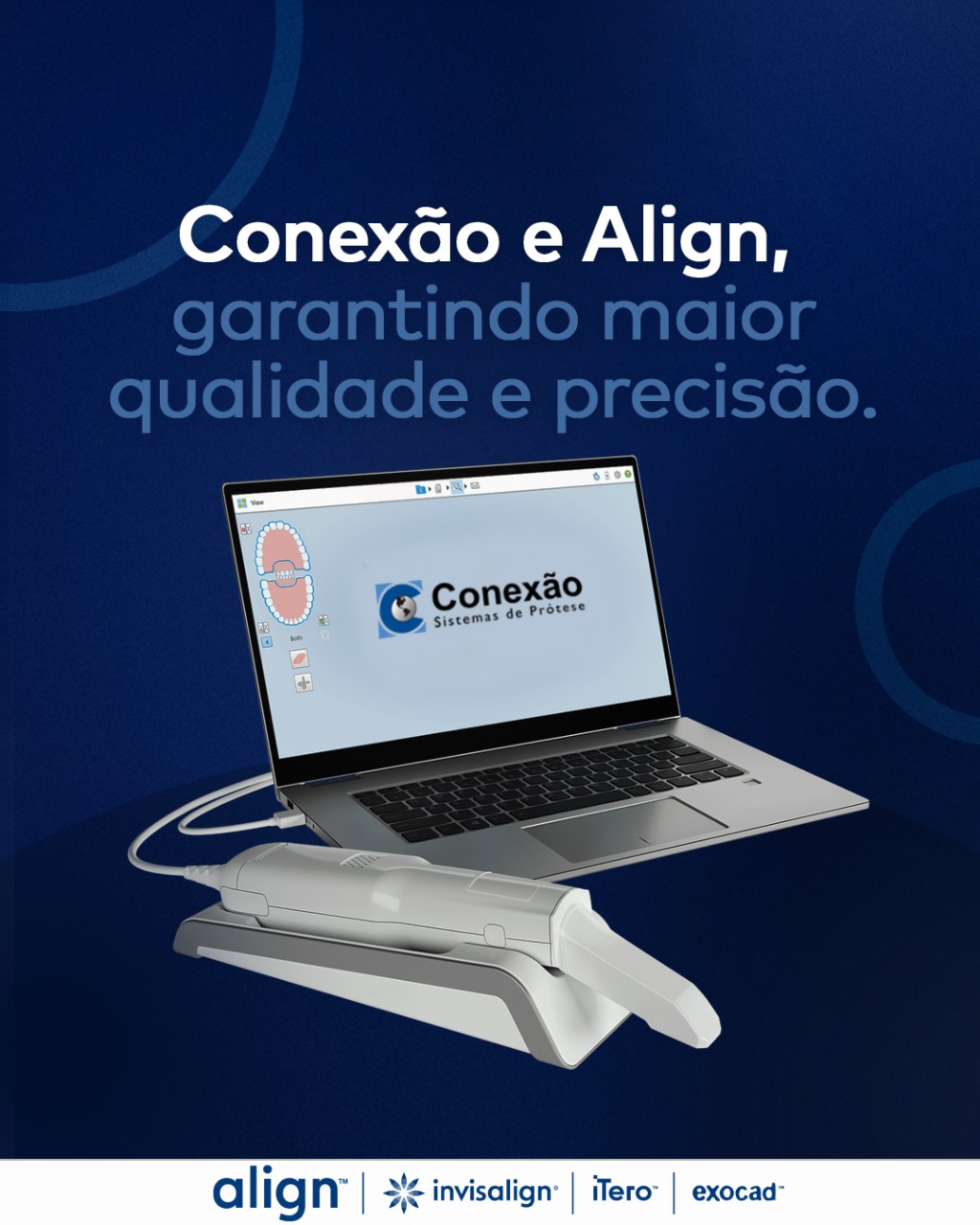 Conexão e Align - Parceria Tecnológica
