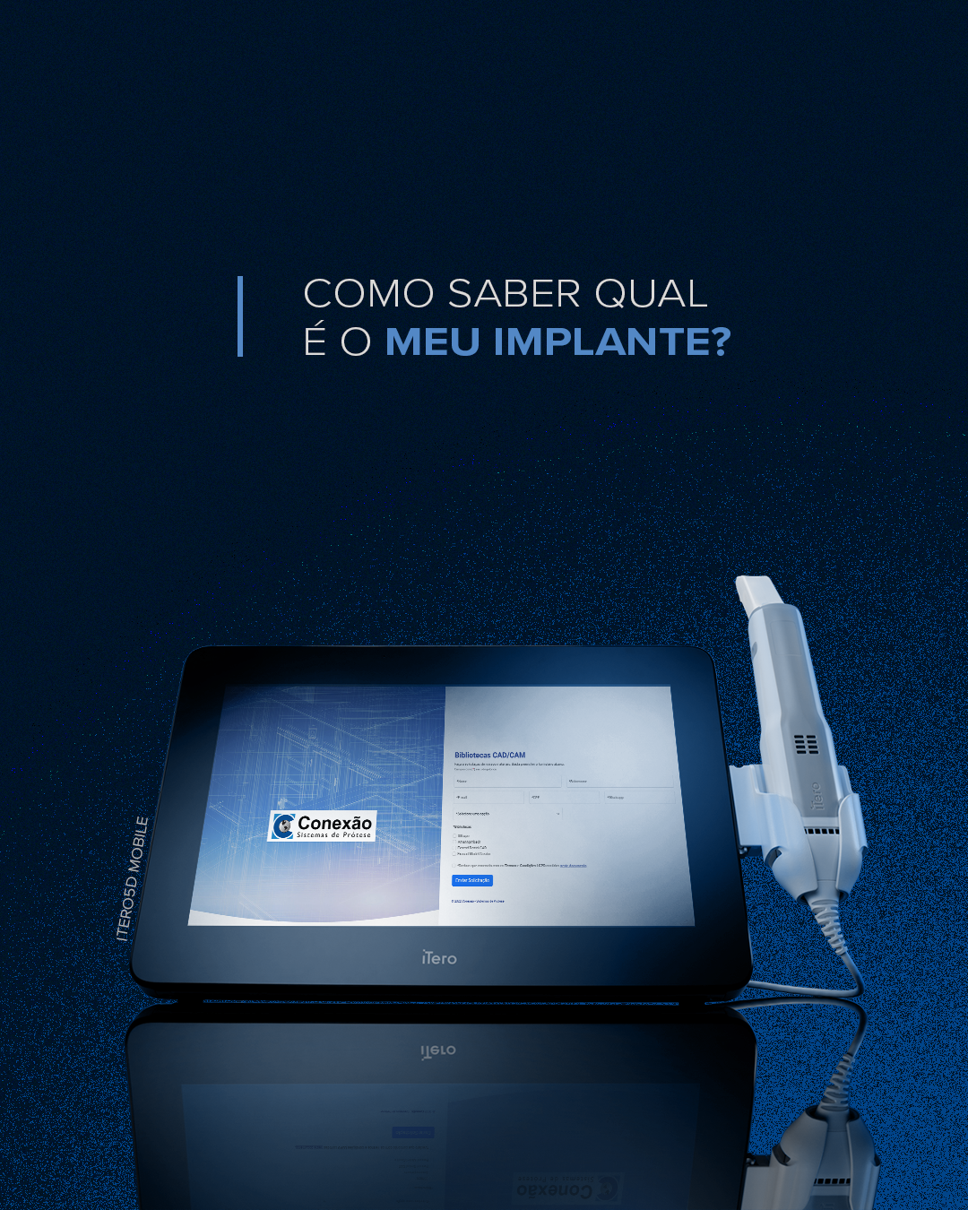 Como Saber Qual é o Meu Implante?